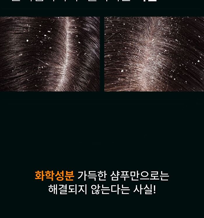Therapy Scalp Scaling Scrub - 200g
