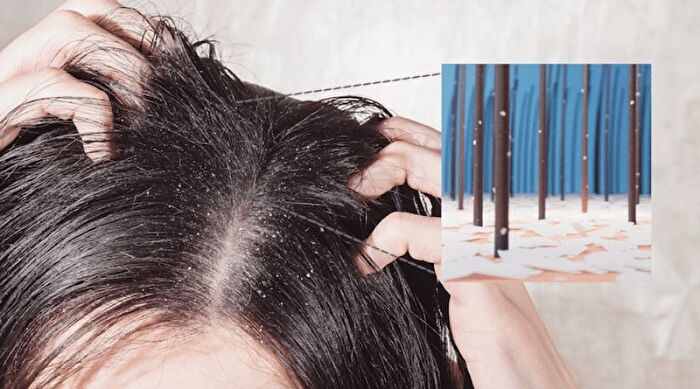 Therapy Scalp Scaling Scrub - 200g