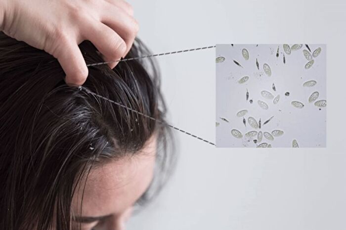 Therapy Scalp Scaling Scrub - 200g