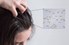 Therapy Scalp Scaling Scrub - 200g