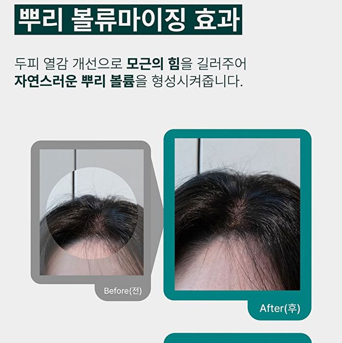 Therapy Scalp Scaling Scrub - 200g