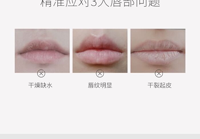 Moisture Lip Balm - 4g