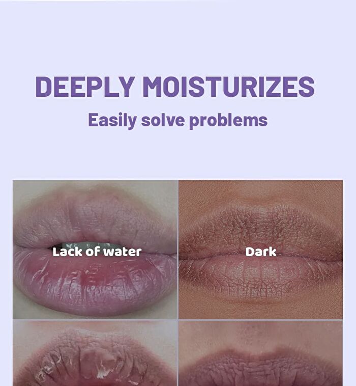 Moisturizing Bubble Lip Mask Set - Set  - 10g