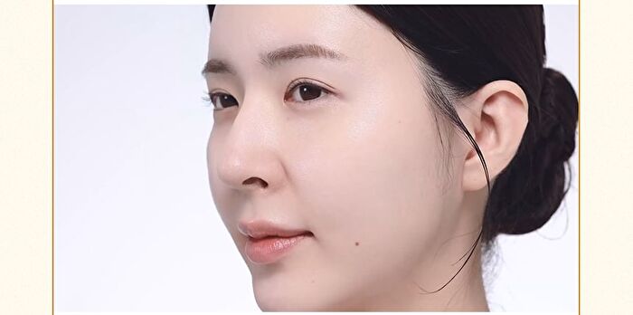 Rice Potato Pore Fresh Wash Off - 150g