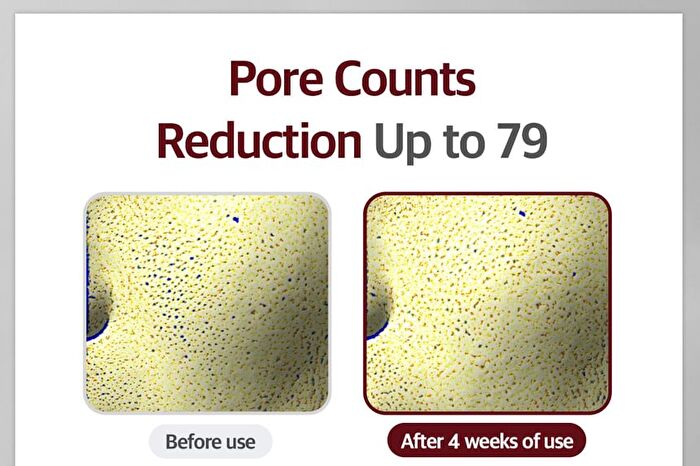 Curepair Melder SOS System Set - 1.5ml x 20 pcs