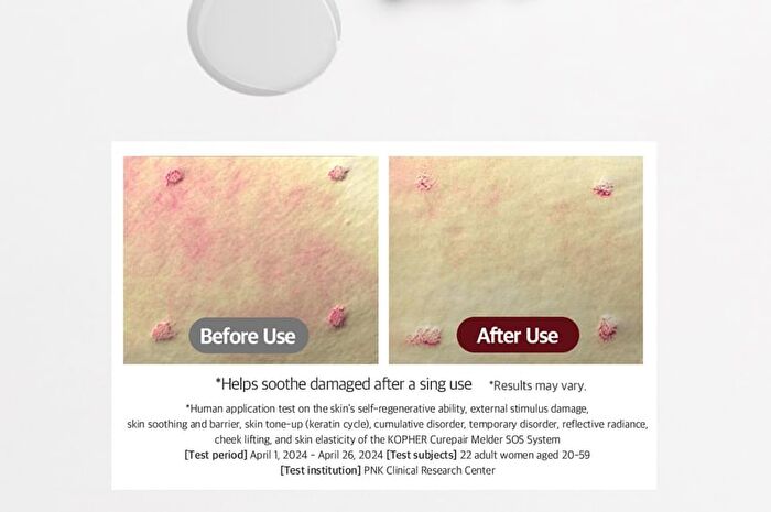 Curepair Melder SOS System Set - 1.5ml x 20 pcs