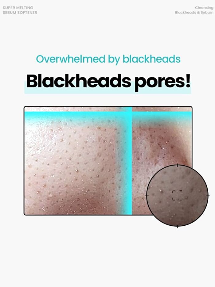 Super Melting Sebum Softener Special Set - 2 pcs