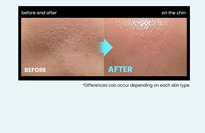 Super Melting Sebum Softener Special Set - 2 pcs