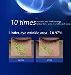 Frozen Anti-Wrinkle Stretch Mask - 35ml x 5pcs