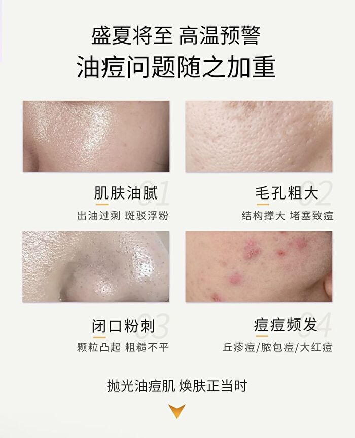 Lactobionic Acid Oil Control Astringent Mask - 25g x 5pcs
