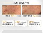 Lactobionic Acid Oil Control Astringent Mask - 25g x 5pcs