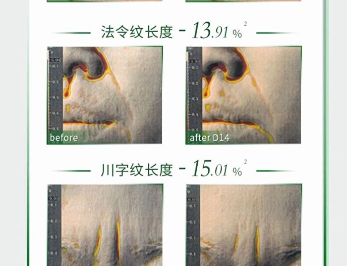 Collagen Anti-Wrinkle Repair Essence - Set (1.3ml x 30pcs)