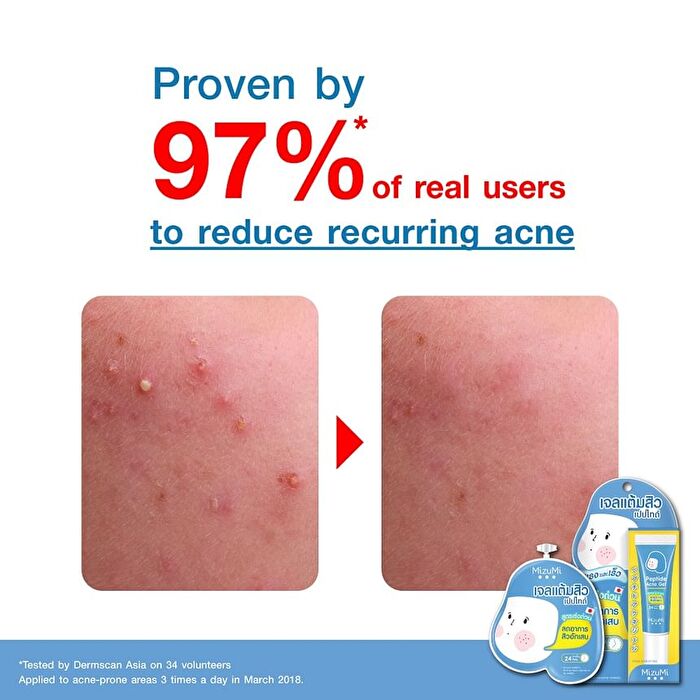Peptide Acne Gel - 9g