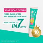 B3 Acne Concentrate Serum - 13g