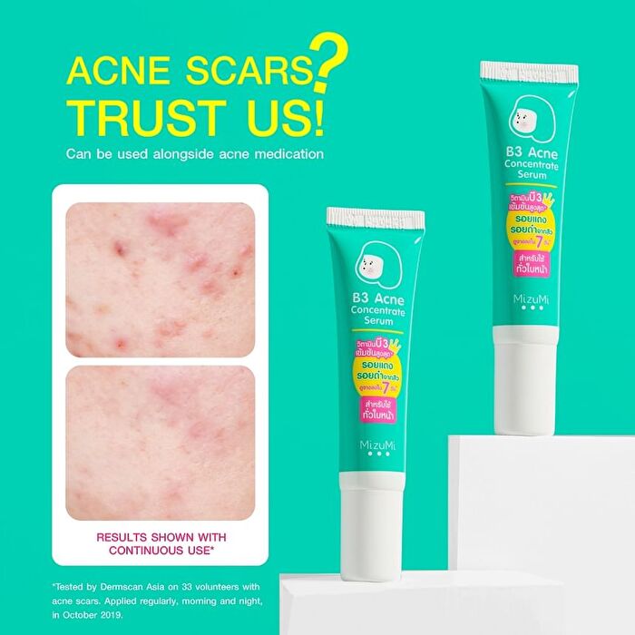 B3 Acne Concentrate Serum - 13g