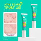 B3 Acne Concentrate Serum - 13g