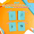 UV Acne Matte Serum+ - 13g
