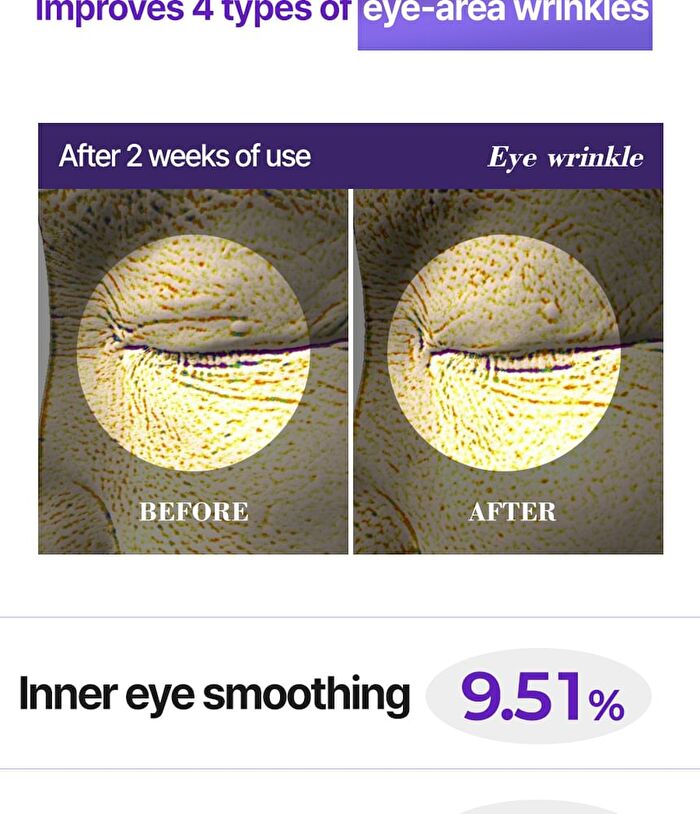 EGF Peprink Eye Cream - 15ml