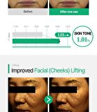 PDRN Liposomal 14 Ampoule - 50ml