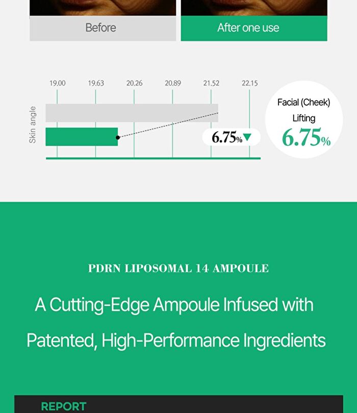 PDRN Liposomal 14 Ampoule - 50ml