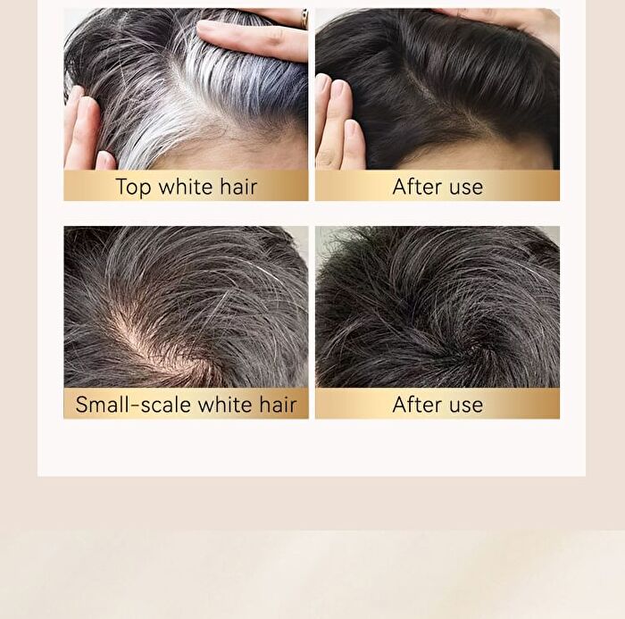 Covering Gray Hair - 3 Colors - #02 Dark Brown - 20ml