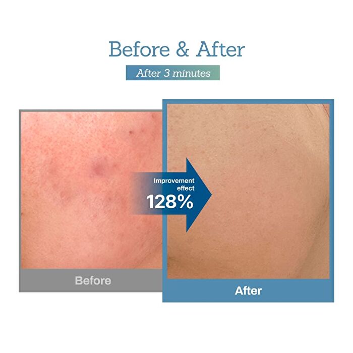 Blue Centella Calming Cream - 100ml