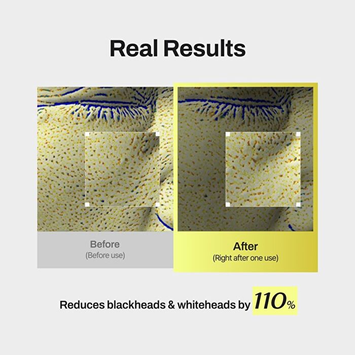 NIACIN x BHA Pore Mild Clear Pad - 60 pads