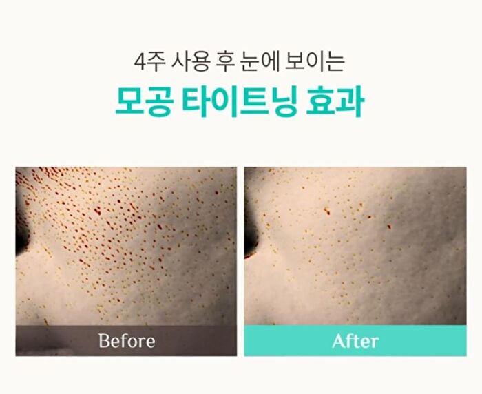 Pore Zero Fresh All In One - 150ml