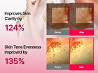 Tranexamic Acid Skin Booster Set - 1 set