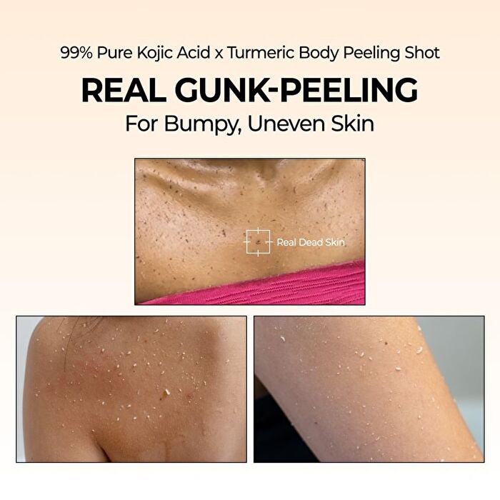 Peel Shot Exfoliating Kojic Acid Turmeric Spray - 200ml