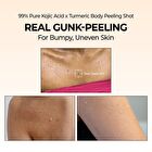 Peel Shot Exfoliating Kojic Acid Turmeric Spray - 200ml