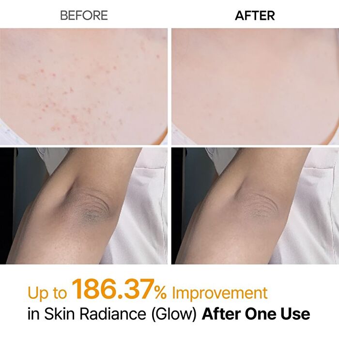 Peel Shot Exfoliating Kojic Acid Turmeric Spray - 200ml