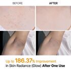 Peel Shot Exfoliating Kojic Acid Turmeric Spray - 200ml