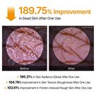 Peel Shot Exfoliating Kojic Acid Turmeric Spray - 200ml