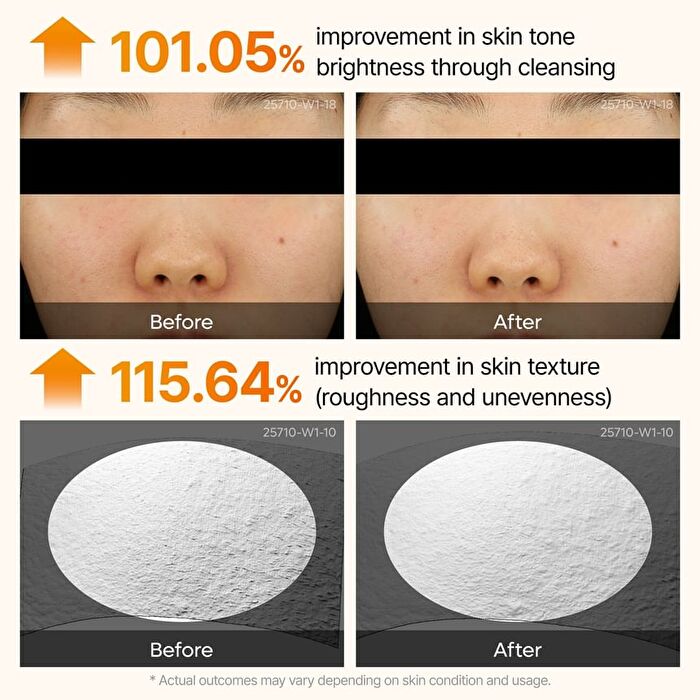 Peel Shot Exfoliating Kojic Acid Turmeric Serum - 80ml