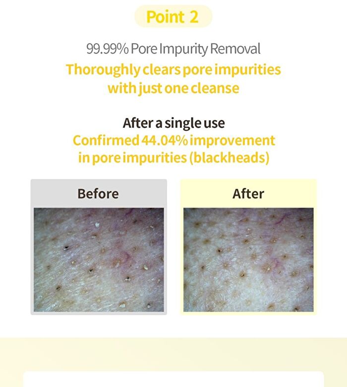 Lemon Sparkling Cleansing Balm - 150ml