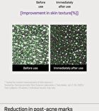 Retinol Bakuchiol Bubble Toner - 100ml