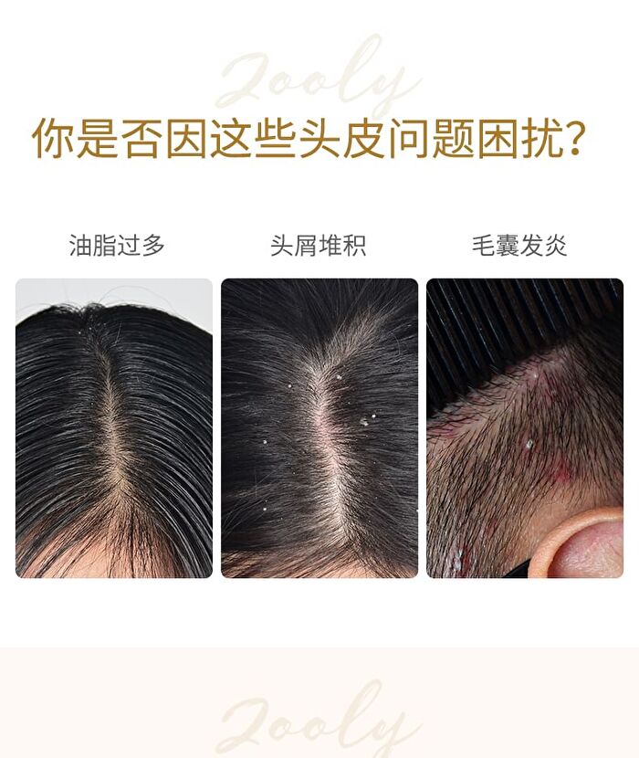 Zooly No.8 Ginger Scalp Soothing Massage Cream (1pc) - 1pc - 25ml