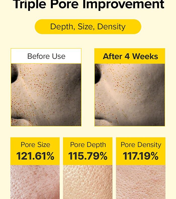 Spicule Retinol PDRN Cream - 15g