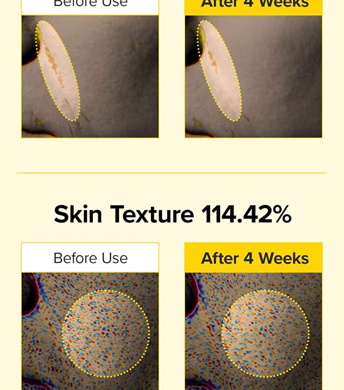 Spicule Retinol PDRN Cream - 15g