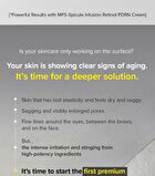 Spicule Retinol PDRN Cream - 15g