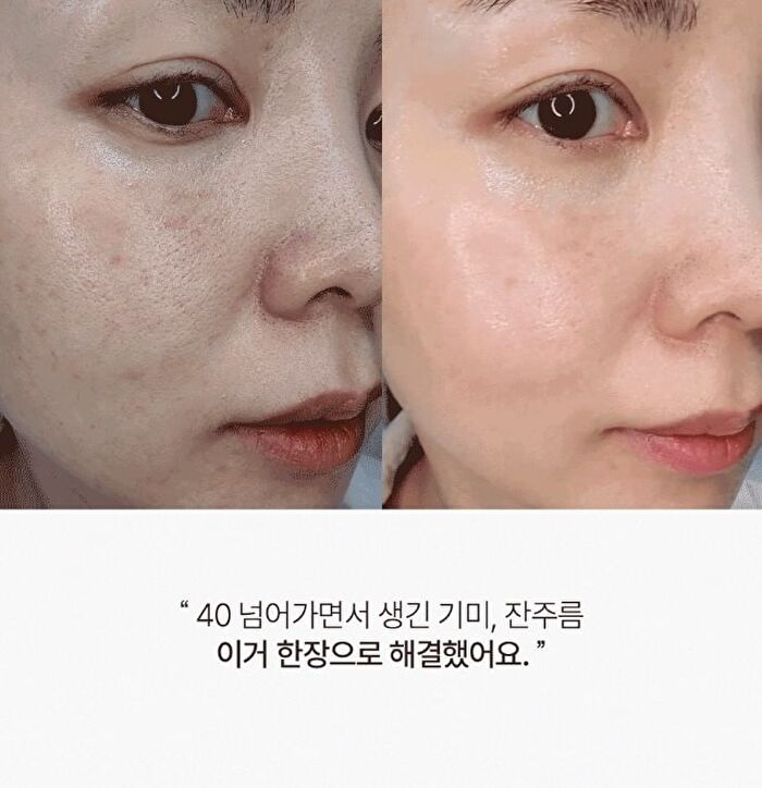 Glutathione All-in-One Film Set - 3 pcs