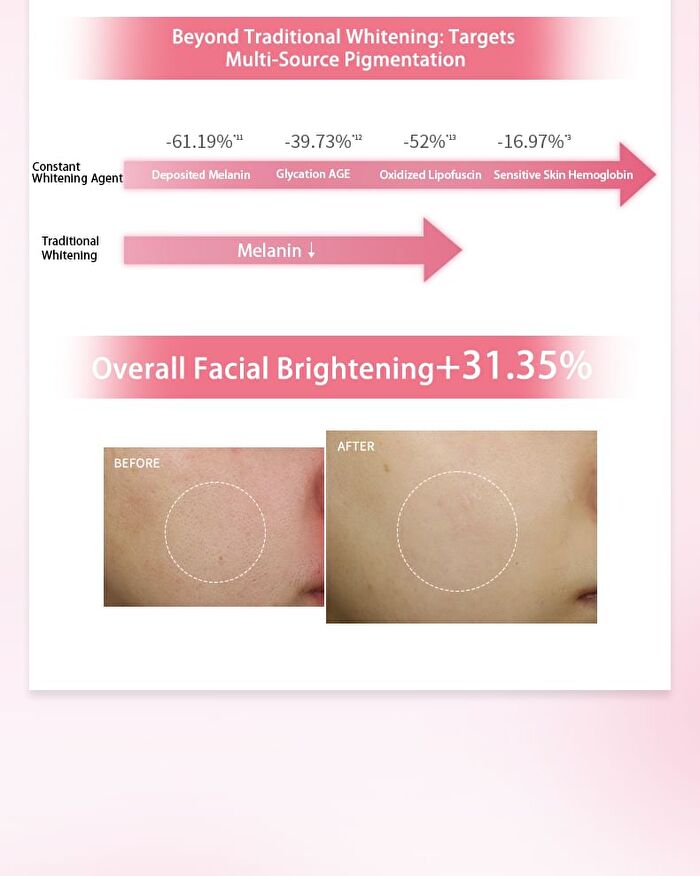Bright-Plus Whitening Lotion - 100g