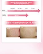 Bright-Plus Whitening Lotion - 100g