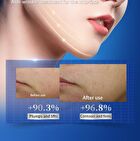 Sodium Hyaluronate Collagen Single Use Essence - 1.5ml x 30pcs