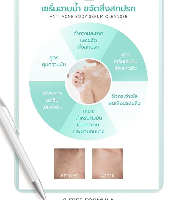 Anti Acne Body Serum Cleanser - 320ml