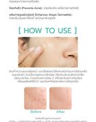 Anti Dark Spot Gel - 15g