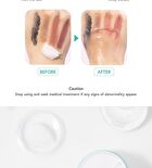 Anti Acne Makeup-Melting Balm - 40g