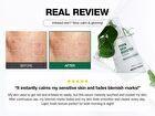 PDRN Skin Booster Set - 1 Set