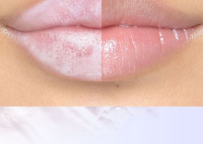 Bubble Cleansing Lip Cream - 10g